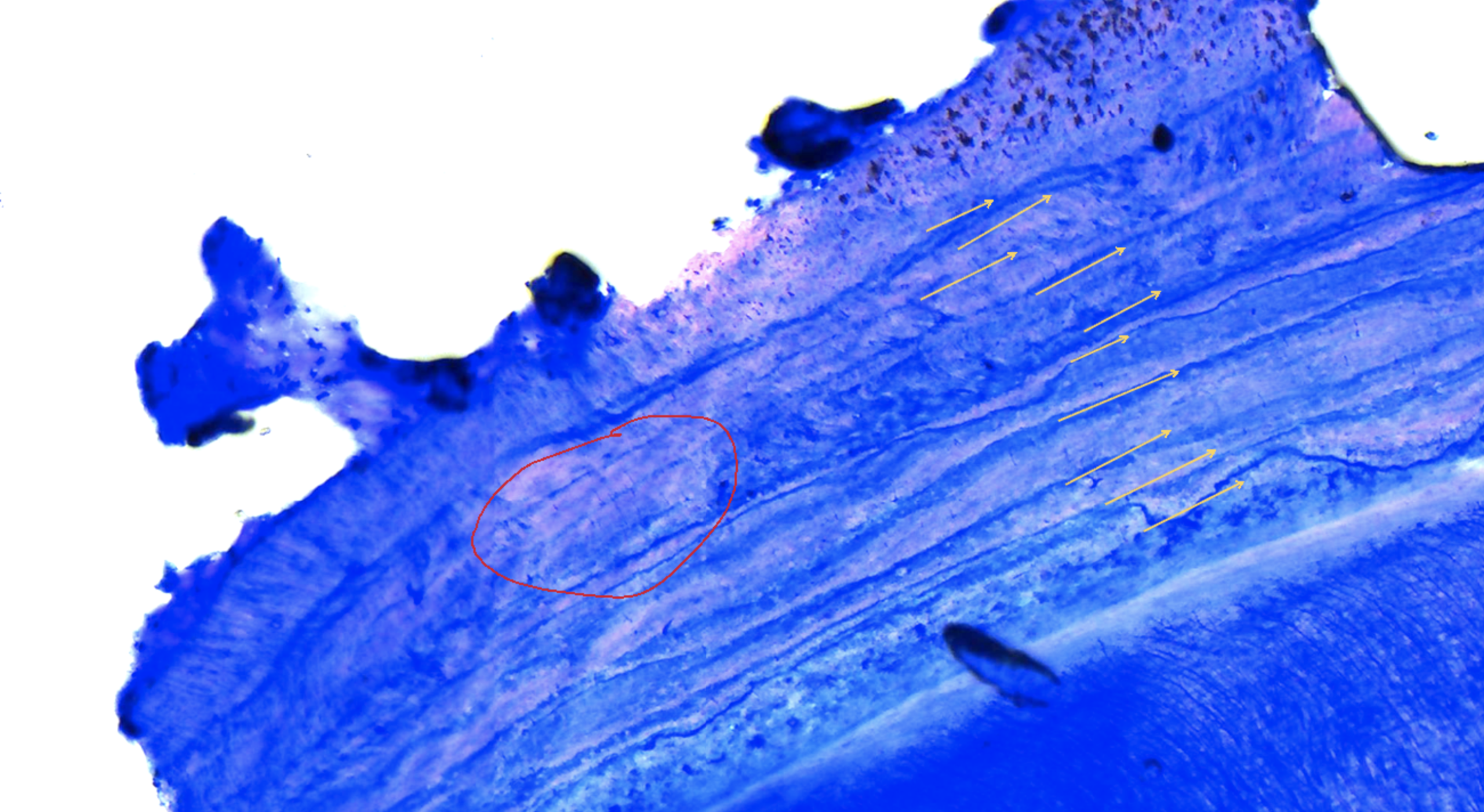 Microscope slide showing over-decalcified tissue