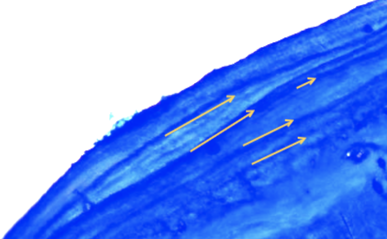 Microscope slide showing line stacking