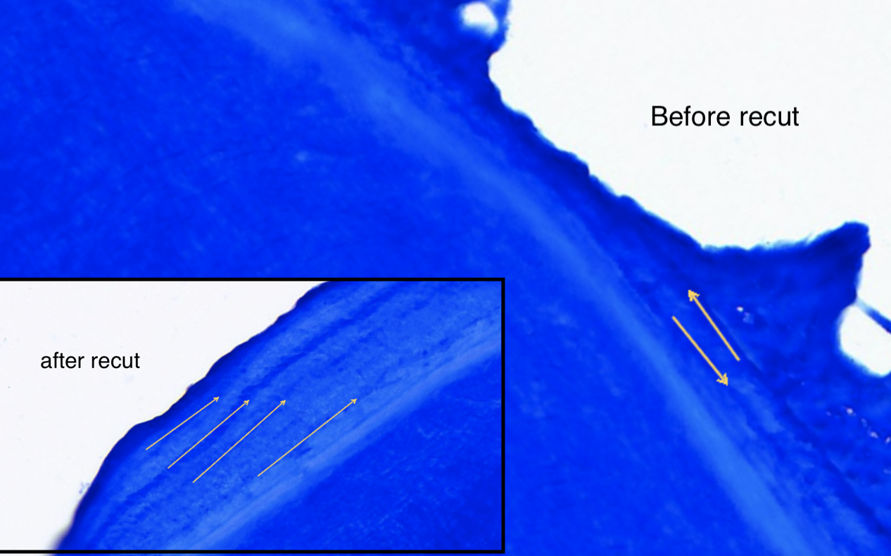 Example of sectioning depth variation