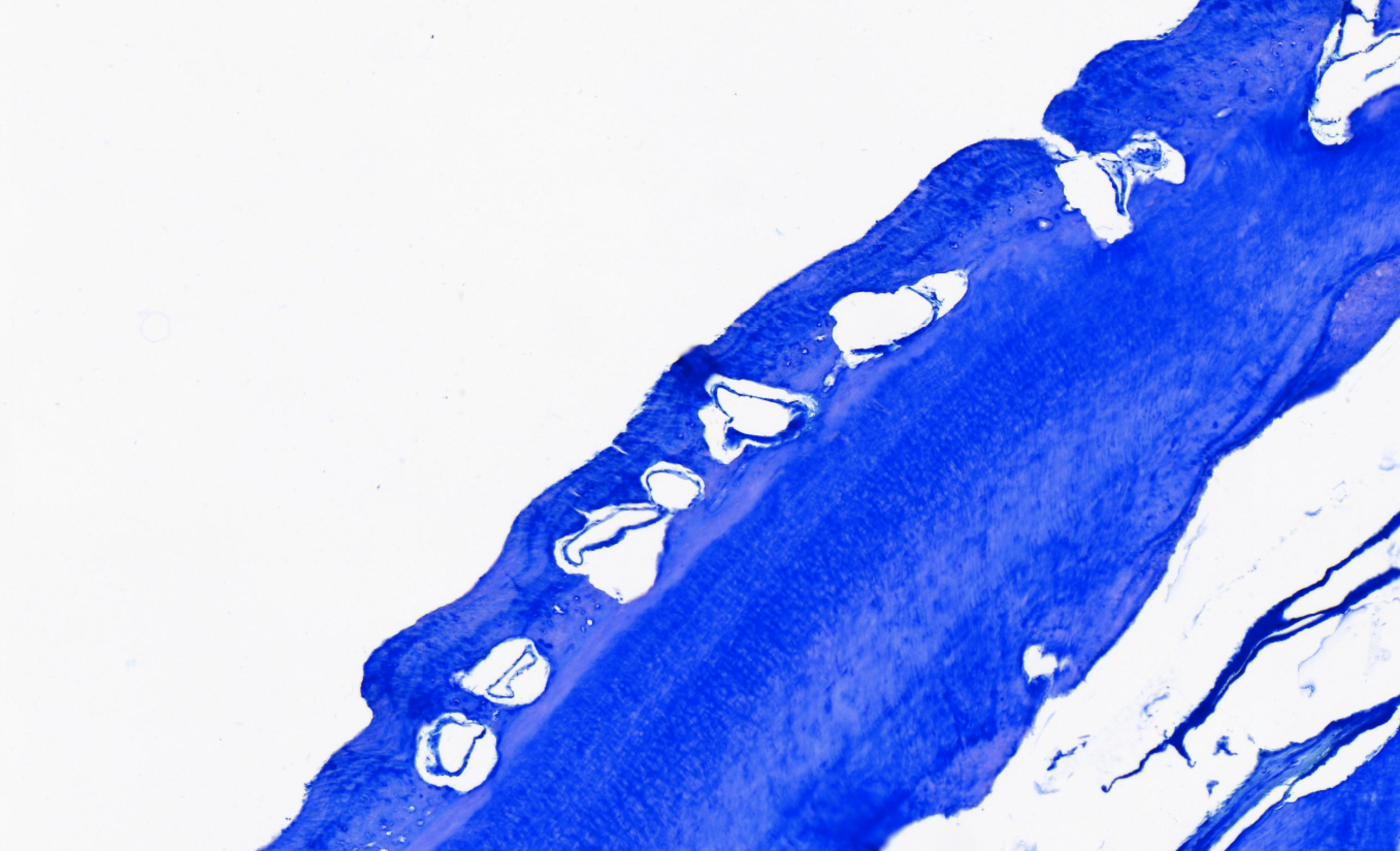 Microscope slide showing messy cementum